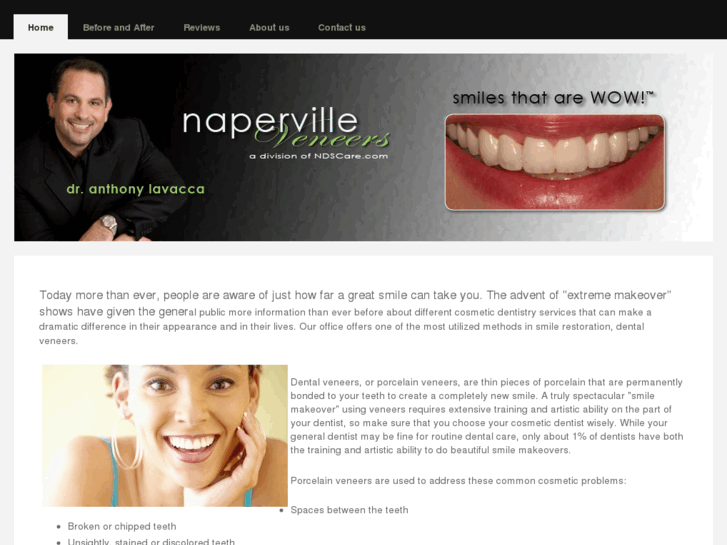 www.napervilleveneers.com