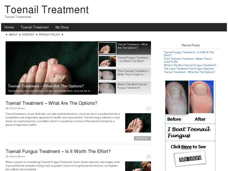 www.toenailtreatment101.com