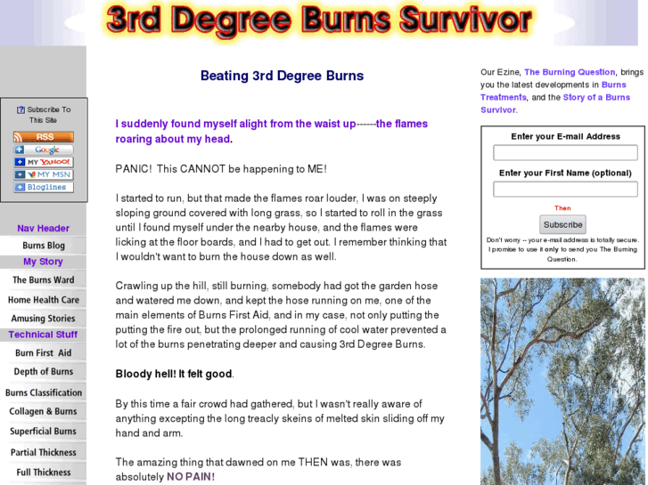 www.3rd-degree-burns-surviver.com