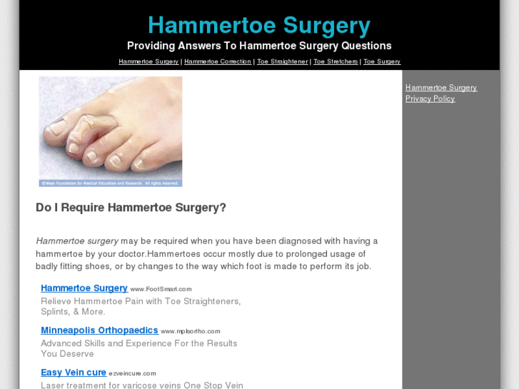 www.hammertoesurgery.org