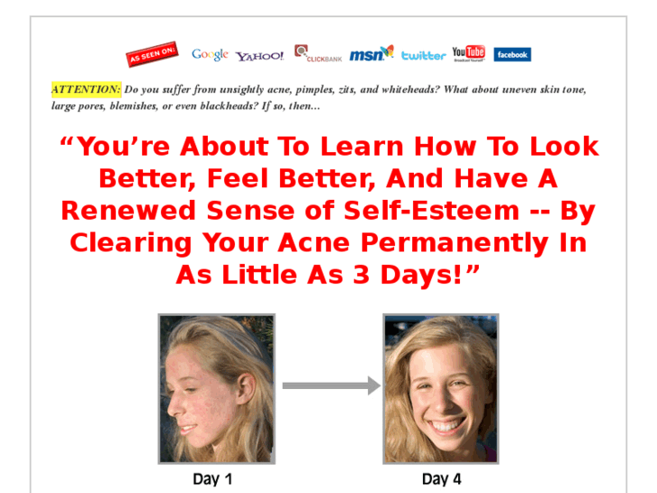 www.acne-freein3days.info