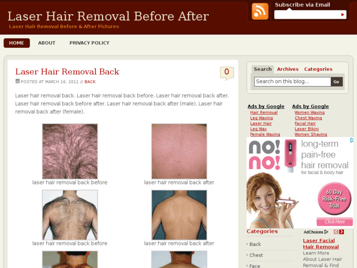 www.laserhairremoval-beforeafter.com