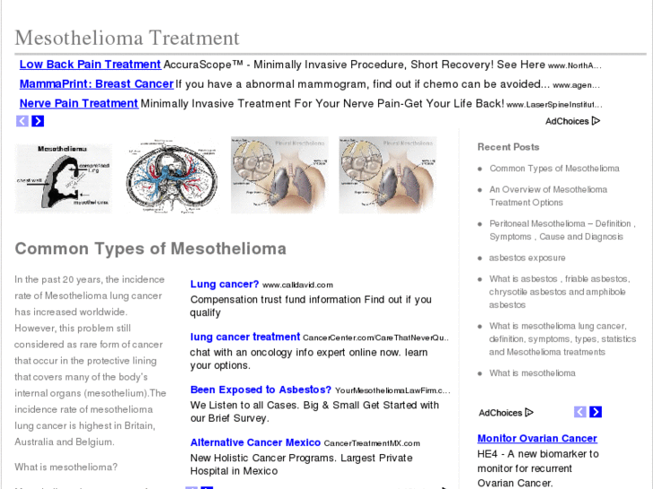 www.mesotheliomatreatmentnews.com