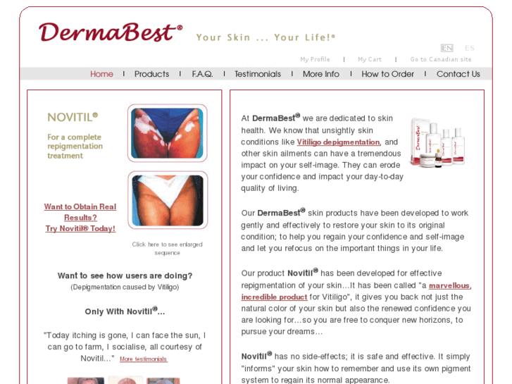 www.dermabest.com