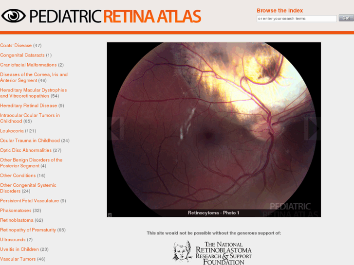 www.retinaatlas.com