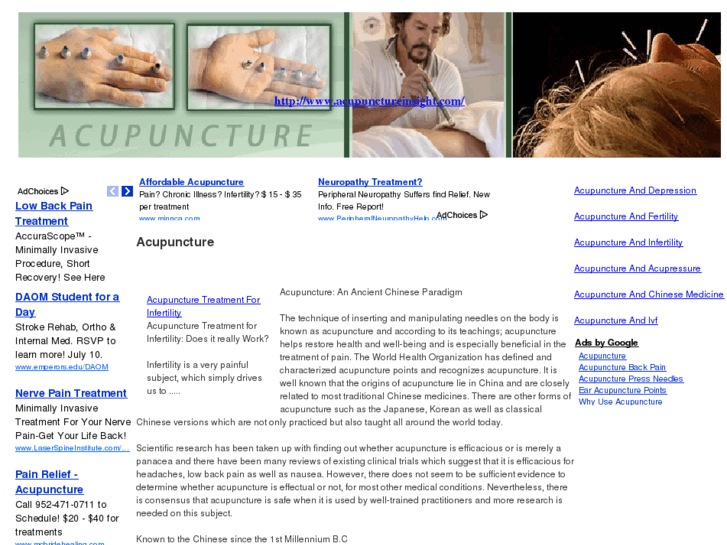 www.acupunctureinsight.com