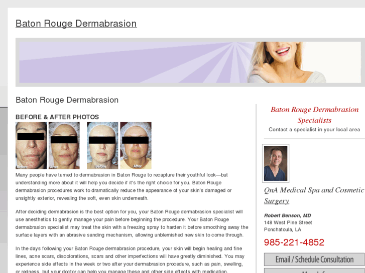 www.batonrougedermabrasion.com