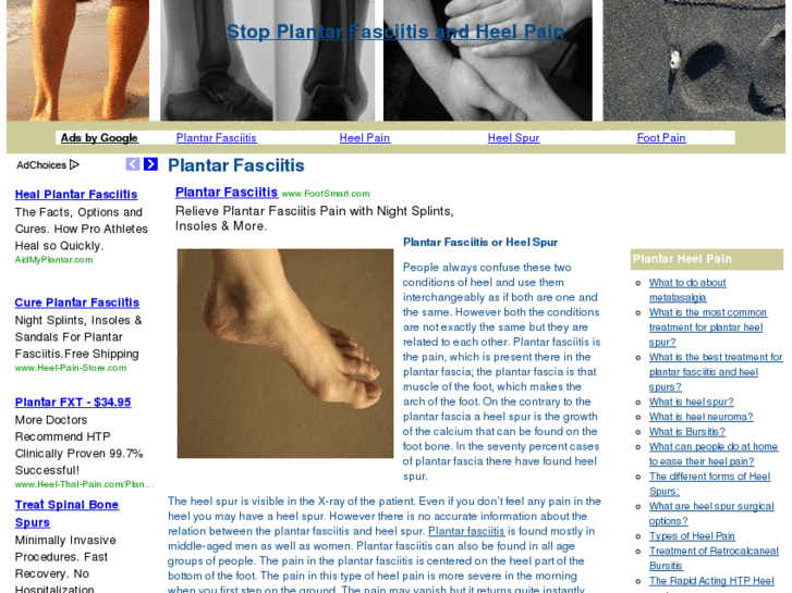 www.plantarfasciitisheelpain.com