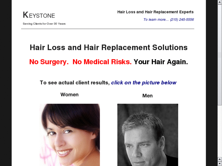 www.hairloss-philadelphia.com