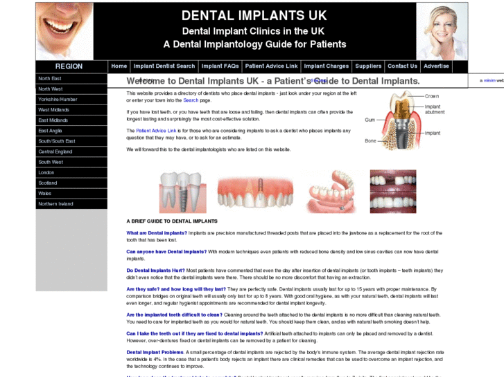 www.dentalimplants-uk.co.uk