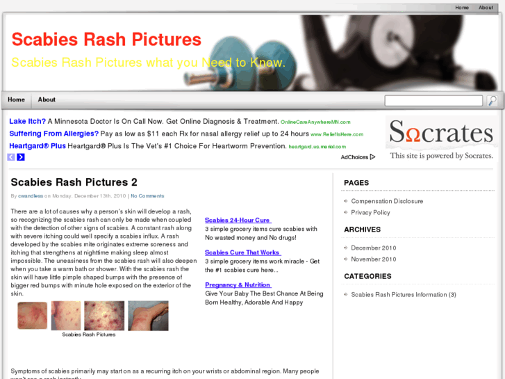 www.scabiesrashpictures.net