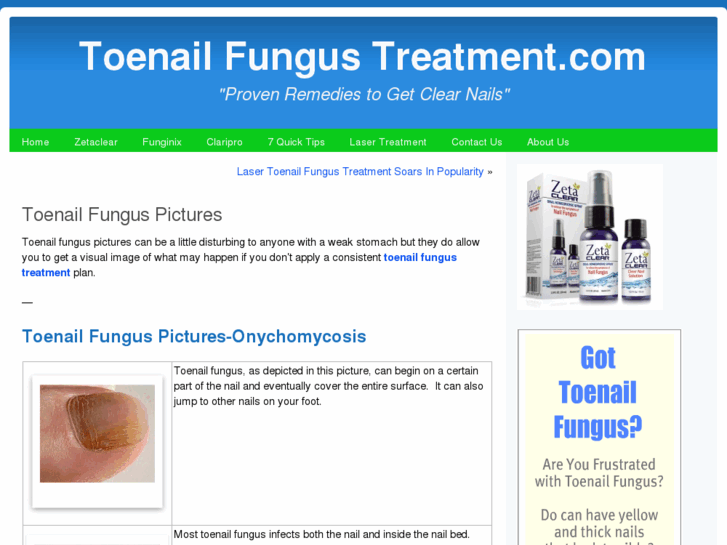 www.toenailfunguspictures.com