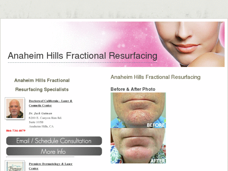 www.anaheimhillsfractionalresurfacing.com