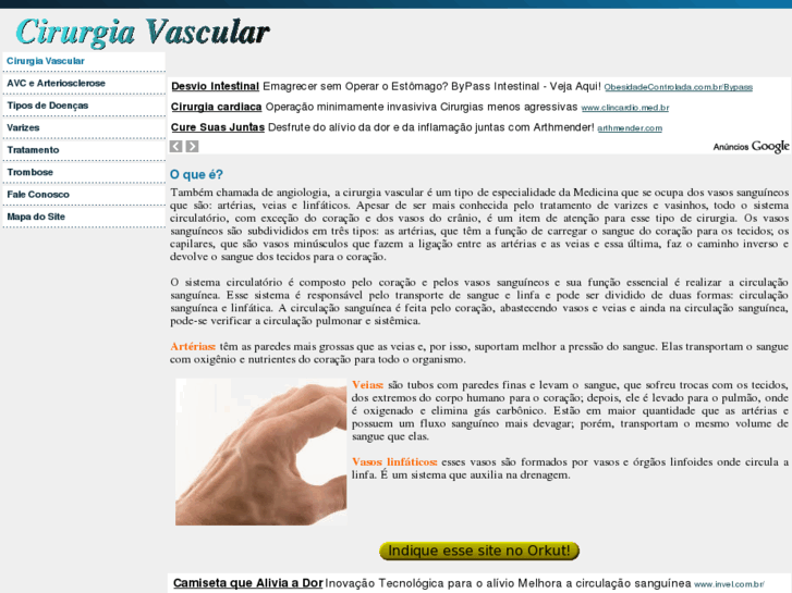 www.cirurgia-vascular.info