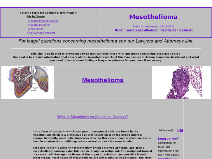 www.mesotheliomaasbestoscancer.com