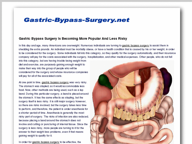 www.gastric-bypass-surgery.net