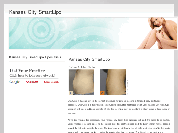 www.kansascitysmartlipo.com