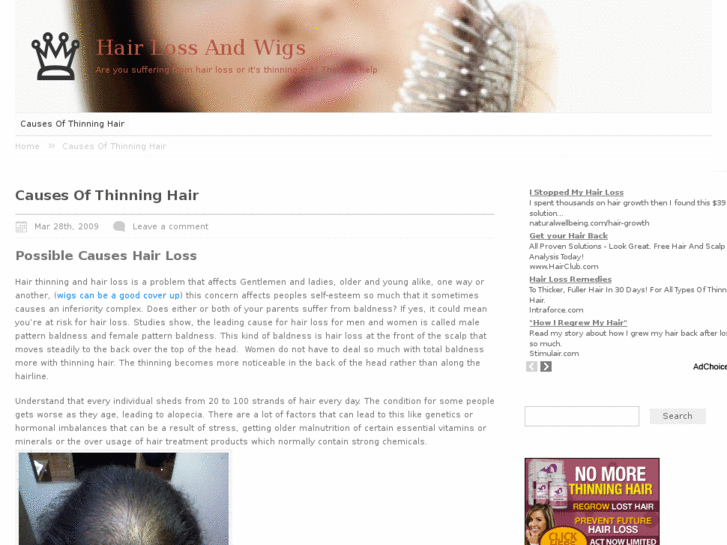 www.hairlossandwigs.com