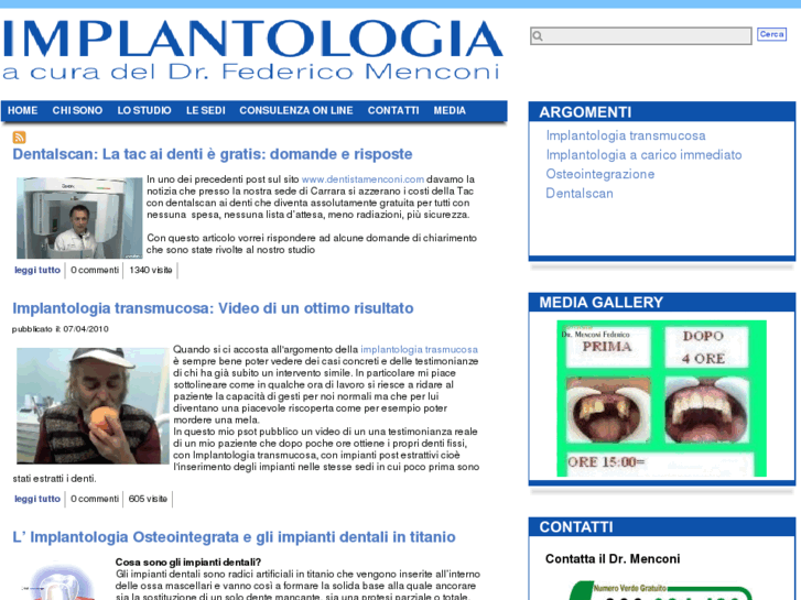 www.implantologiamenconi.com