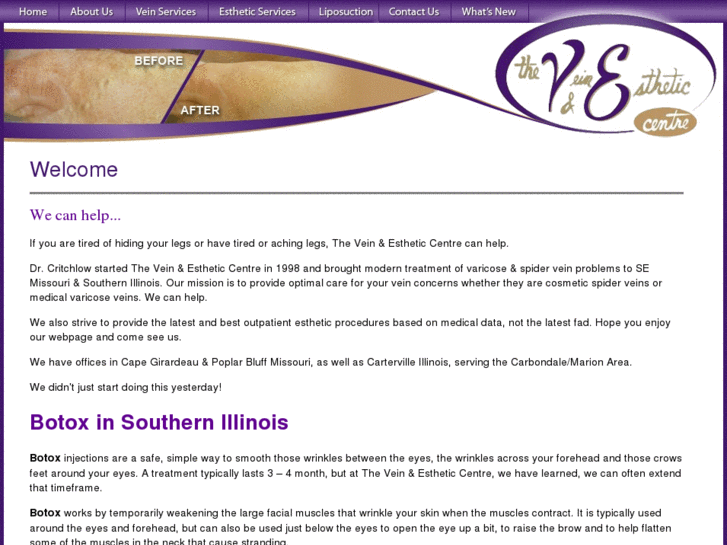 www.botox-southern-illinois.com