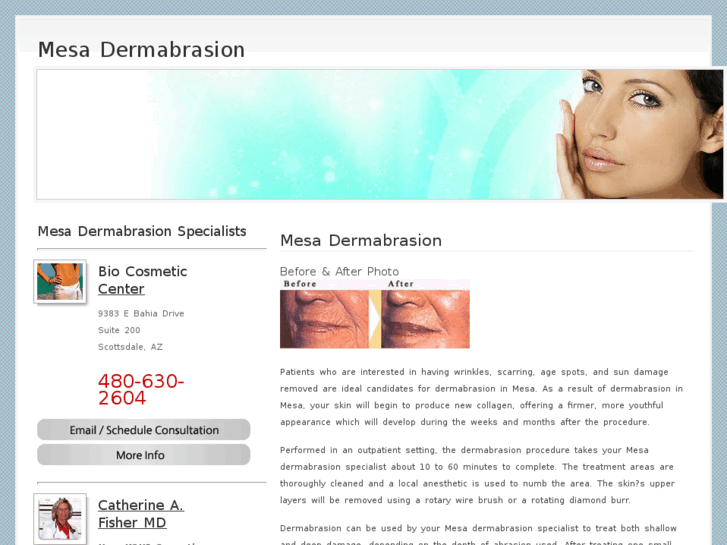 www.mesadermabrasion.com