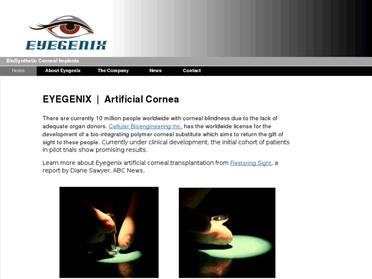 www.eyegenix.com