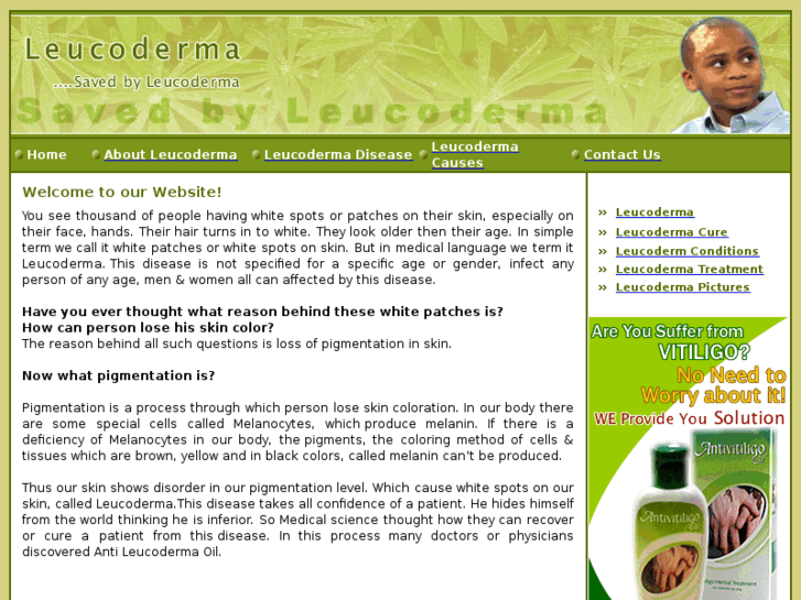 www.leucoderma.info