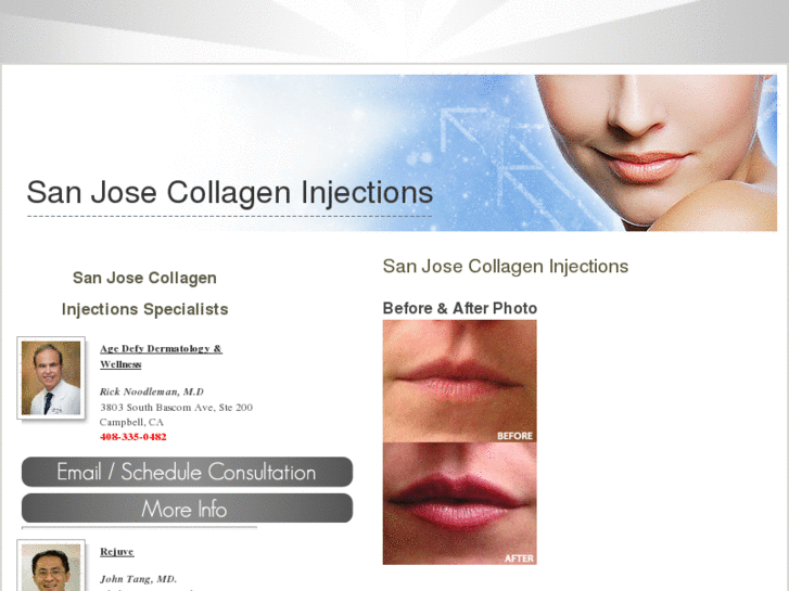 www.sanjosecollageninjections.com