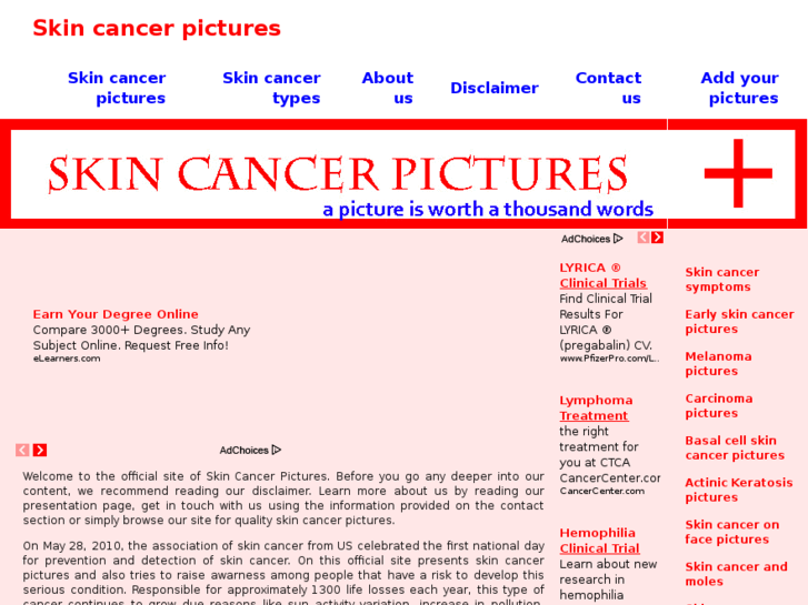 www.skincancerpictures.org