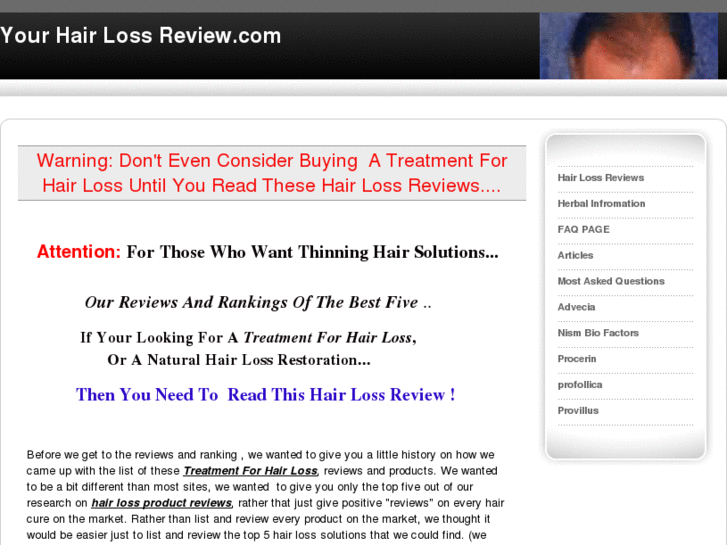 www.your-hair-loss-review.com