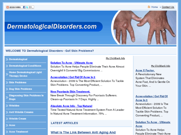 www.dermatologicaldisorders.com