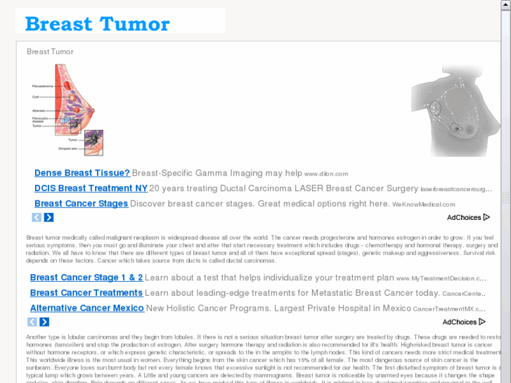 www.breasttumor.org