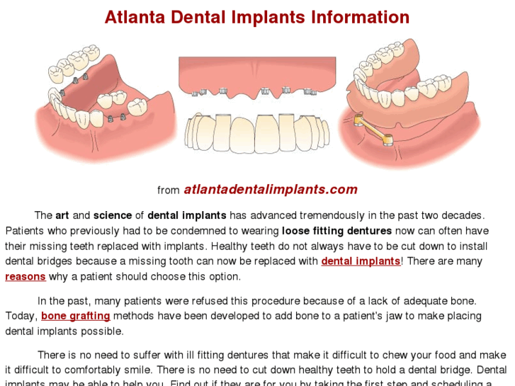 www.atlanta-implants.com