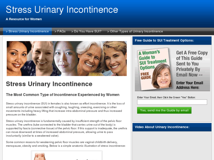 www.stressurinaryincontinence.com