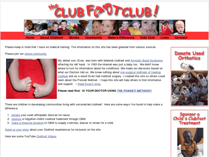 www.clubfootclub.org