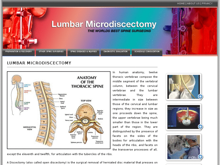 www.lumbarmicrodiscectomy.info