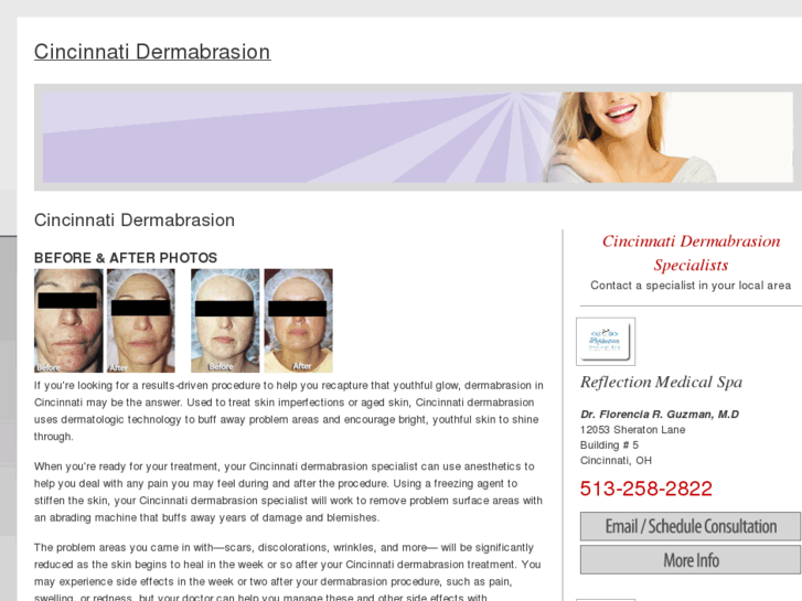 www.cincinnatidermabrasion.com