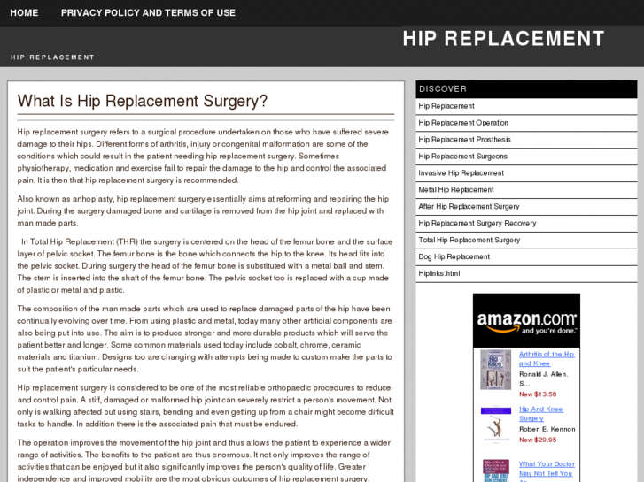 www.hip-replacement-advisor.com