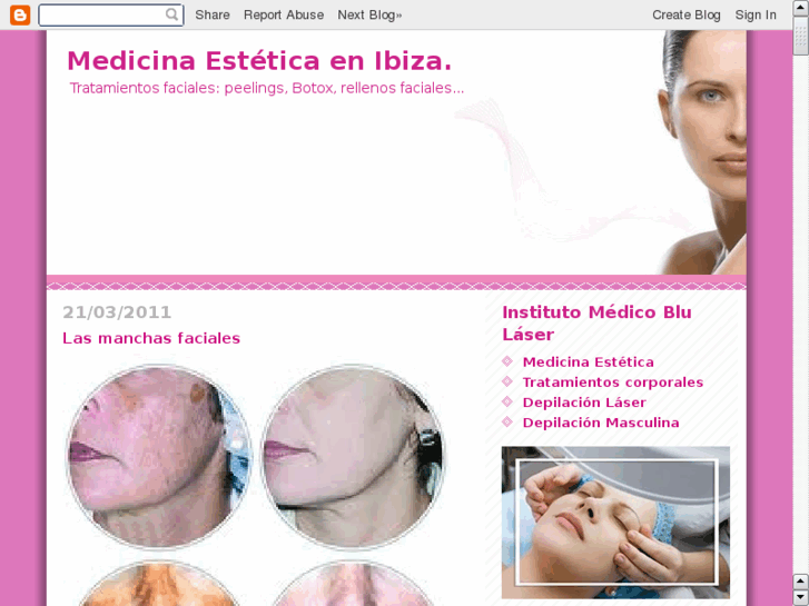 www.botoxibiza.es
