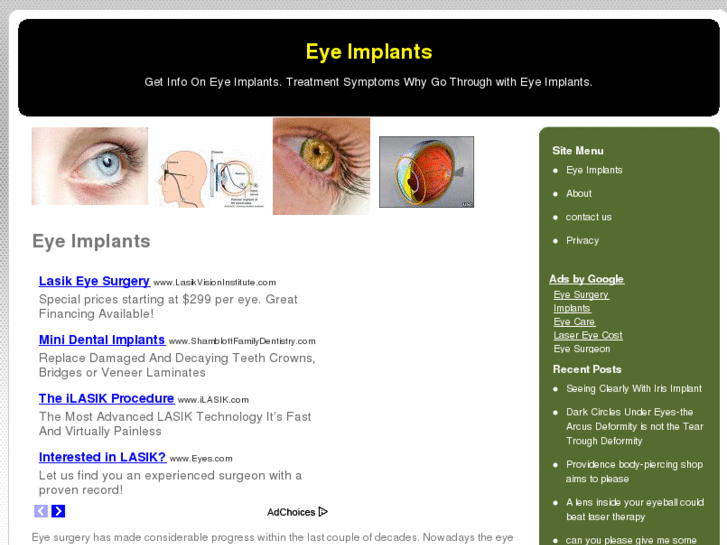 www.eyeimplants.org