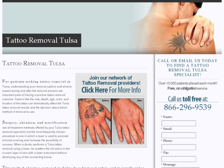 www.tulsatattooremoval.com