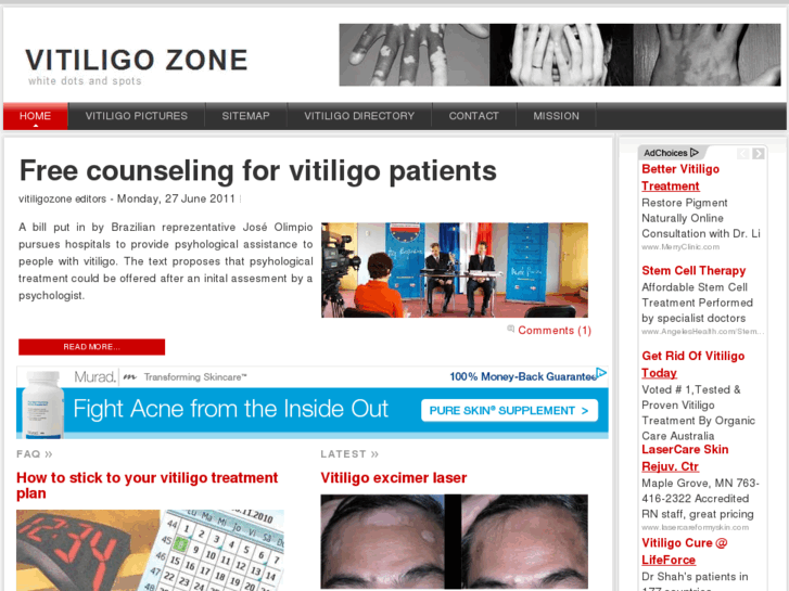 www.vitiligozone.com