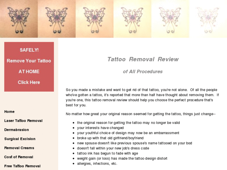 www.tattooremovalreview.com