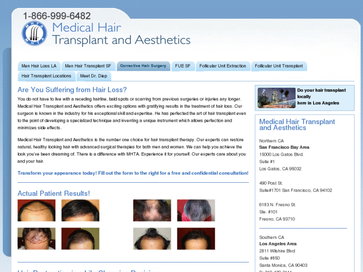 www.male-hair-loss-transplant.com