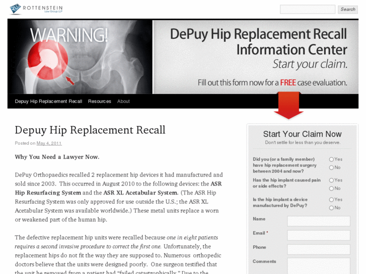 www.depuyhipreplacementrecall.com