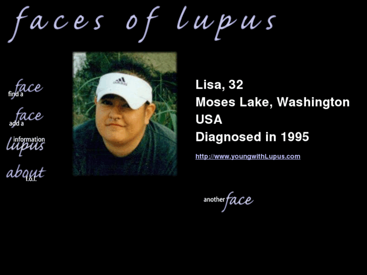 www.facesoflupus.com
