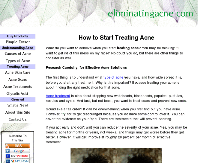 www.eliminatingacne.com