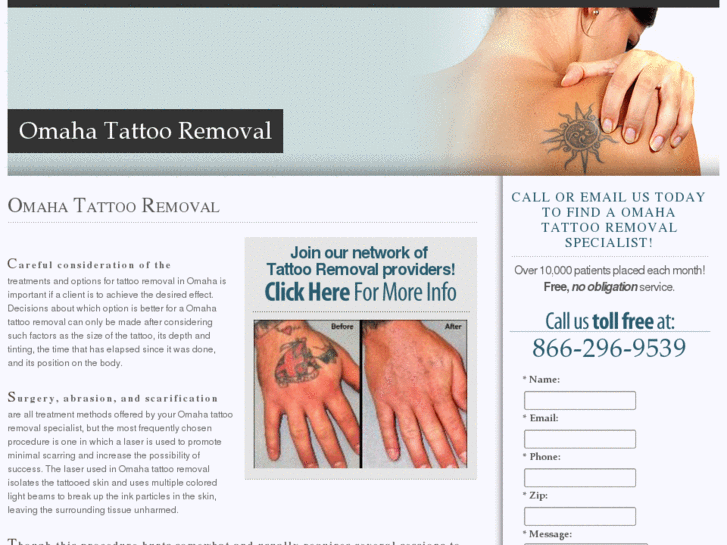 www.omahatattooremoval.com