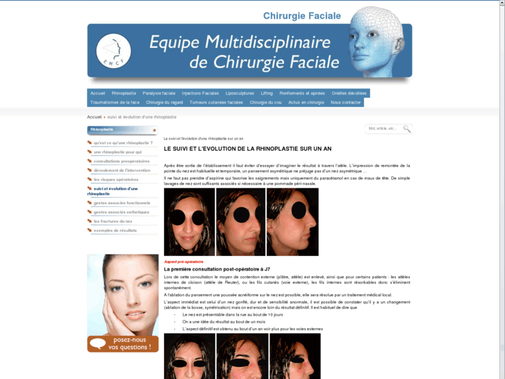 www.rhinoplastie-paris.org