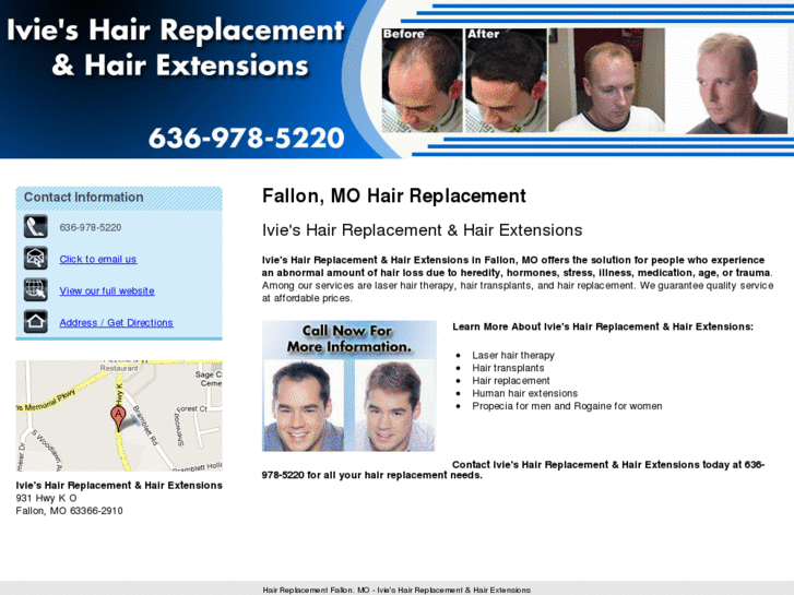 www.ivieshairreplacement.net